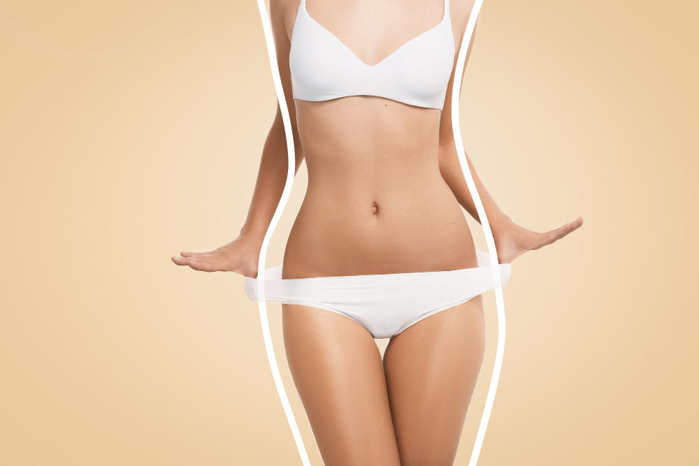 Fleur-de-lis abdominoplasty and excision of excess skin of the lateral  thighs and buttocks