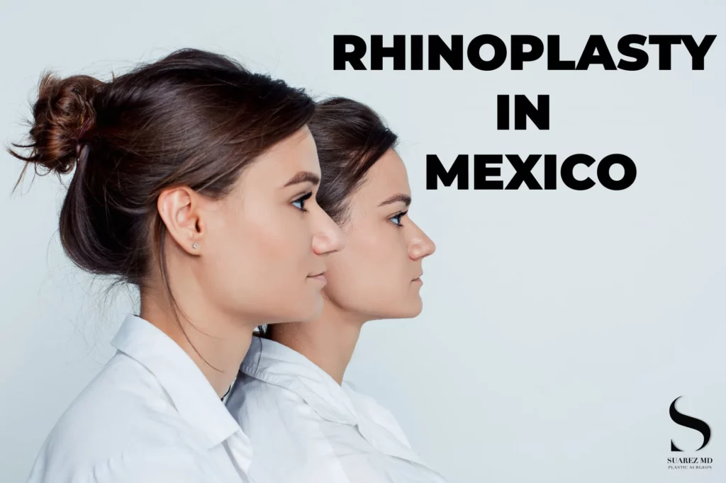 Principal Image Rhinoplasty in Mexico