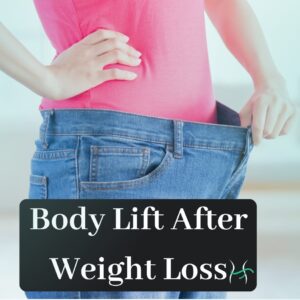 Nody lLift After Weight Loss - 1